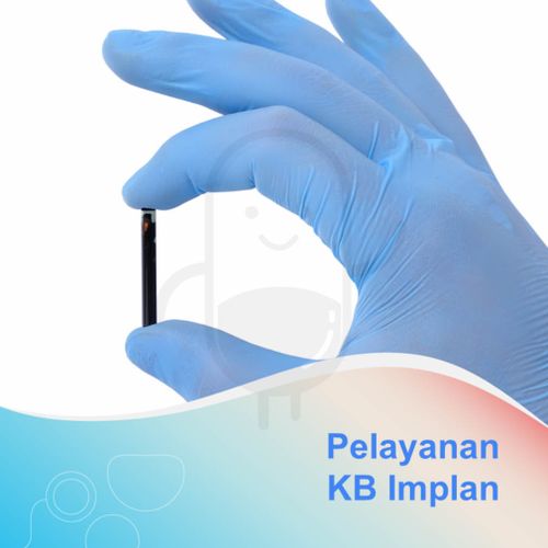 Kb Implan Voucher Layanan Klinik Astuti Medika Pratama Kegunaan