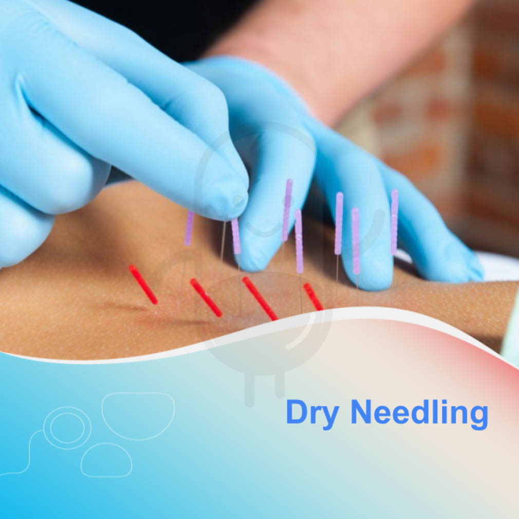 Dry Needling Klinik Eminence Kegunaan Efek Samping Dosis Dan Aturan Pakai 9338