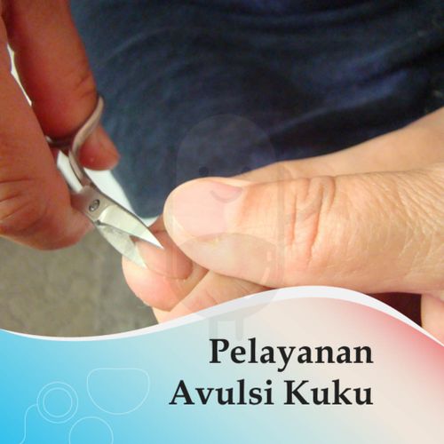 AVULSI KUKU - KLINIK MITRA SEHAT