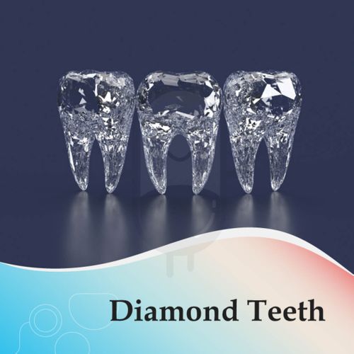 DIAMOND TEETH - KLINIK STELLA MEDIKA