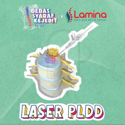 ENDOSCOPY PSLD/PELD 2 LEVEL - LAMINA