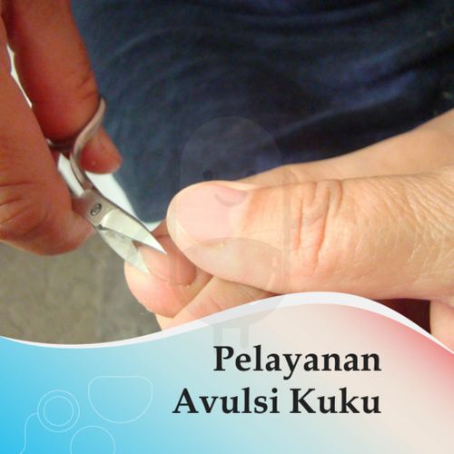 AVULSI KUKU - KLINIK MUTIARA 1 ARH