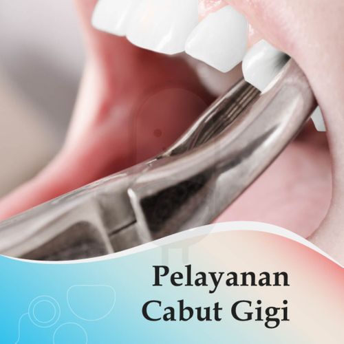 VOUCHER LAYANAN CABUT GIGI - KLINIK DD