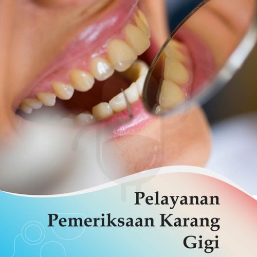 PEMBERSIHAN KARANG GIGI - KLINIK STELLA MEDIKA 1