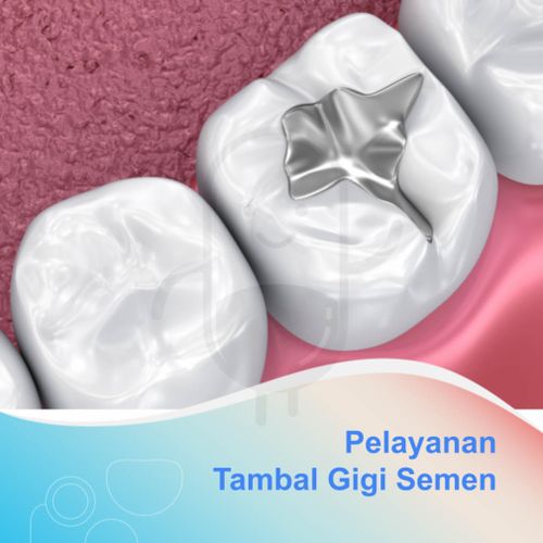 TAMBAL GIGI SEMEN - KLINIK KENDEDES