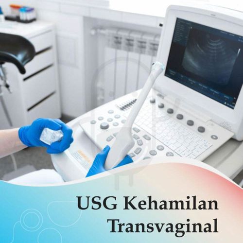 USG KEHAMILAN TRANSVAGINAL - KLINIK WAHID - Kegunaan, Efek Samping ...