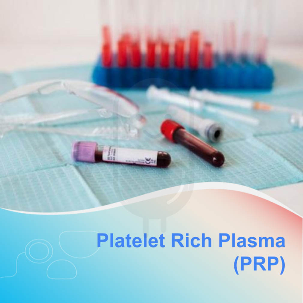 PLATELET RICH PLASMA (PRP) - KLINIK EMINENCE - Kegunaan, Efek Samping ...